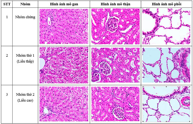 Hình 5. Ảnh giải phẫu mô gan, thận và phổi (nhuộm HE, độ phóng đại 400 lần)
